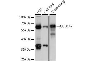 Western blot analysis of extracts of various cell lines, using CCDC47 antibody (ABIN7266438) at 1:1000 dilution. (CCDC47 Antikörper  (AA 224-483))