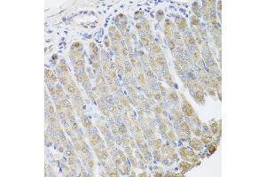 Immunohistochemistry of paraffin-embedded mouse stomach using BGLAP antibody at dilution of 1:100 (x40 lens). (Osteocalcin Antikörper)