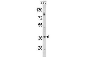 Image no. 1 for anti-Distal-Less Homeobox Protein 2 (DLX2) (Middle Region) antibody (ABIN452916) (DLX2 Antikörper  (Middle Region))