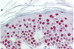 Human Skin (formalin-fixed, paraffin-embedded) stained with SET antibody ABIN297641 at 10 ug/ml followed by biotinylated goat anti-rabbit IgG secondary antibody ABIN481713, alkaline phosphatase-streptavidin and chromogen. (SET/TAF-I Antikörper  (AA 66-81))