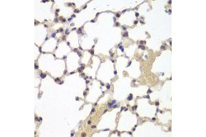 Immunohistochemistry (IHC) image for anti-Estrogen Receptor 2 (ESR2) (AA 1-280) antibody (ABIN6219642) (ESR2 Antikörper  (AA 1-280))