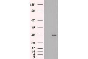 HEK293T cells were transfected with the pCMV6-ENTRY control (Left lane) or pCMV6-ENTRY BFGF (RC217426) (Right lane) cDNA for 48 hrs and lysed. (FGF2 Antikörper  (AA 10-155))