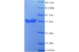SDS-PAGE (SDS) image for Interferon, alpha 4 (IFNa4) (AA 24-189) protein (His-SUMO Tag) (ABIN5709717) (IFNA4 Protein (AA 24-189) (His-SUMO Tag))