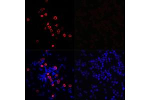 SARS-Coronavirus Nonstructural Protein 8 (SARS-CoV NSP8) Antikörper