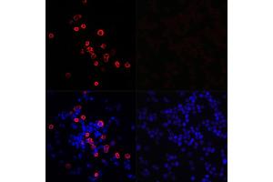 Immunofluorescence analysis of 293T cells transfected with SARS-CoV-2 3CLpro fusion protein (top left) and untreated 293T cells (top right) use SARS-CoV-2 3CLpro Rabbit pAb (ABIN7270151) at dilution of 1:100 (40x lens). (SARS-Coronavirus Nonstructural Protein 8 (SARS-CoV NSP8) Antikörper)