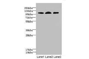 Western blot All lanes: EPHB4 antibody at 2. (EPH Receptor B4 Antikörper  (AA 300-540))