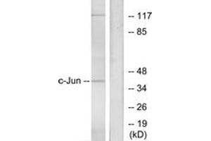 Western blot analysis of extracts from HeLa cells, using c-Jun (Ab-73) Antibody. (C-JUN Antikörper  (AA 40-89))