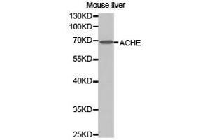 Western Blotting (WB) image for anti-Acetylcholinesterase (AChE) antibody (ABIN1870760) (Acetylcholinesterase Antikörper)