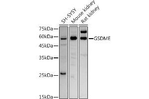 Western blot analysis of extracts of various cell lines, using GSDME antibody (ABIN6127757, ABIN6139554, ABIN6139555 and ABIN6223304) at 1:1000 dilution. (Non-Syndromic Hearing Impairment Protein 5 (GSDME) (AA 1-260) Antikörper)