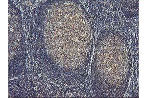 Image no. 6 for anti-Activating Signal Cointegrator 1 Complex Subunit 1 (ASCC1) antibody (ABIN1496741) (ASCC1 Antikörper)