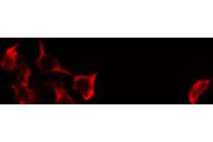 Immunofluorescence (fixed cells) (IF/ICC) image for anti-Cytochrome P450, Family 27, Subfamily A, Polypeptide 1 (CYP27A1) (C-Term) antibody (ABIN6258060)