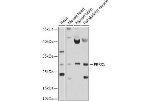 Western blot analysis of extracts of various cell lines, using PRRX1 antibody (ABIN6128507, ABIN6146277, ABIN6146278 and ABIN6214409) at 1:1000 dilution. (PRRX1 Antikörper  (AA 1-90))