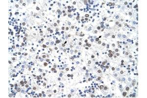 FECH antibody was used for immunohistochemistry at a concentration of 4-8 ug/ml to stain Hepatocytes (arrows) in Human Liver. (FECH Antikörper)