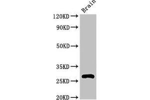 Western Blot Positive WB detected in: Mouse brain tissue All lanes: DNAJC4 antibody at 3. (DNAJC4 Antikörper  (AA 1-155))