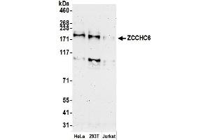 anti-Zinc Finger, CCHC Domain Containing 6 (ZCCHC6) (AA 75-125) antibody