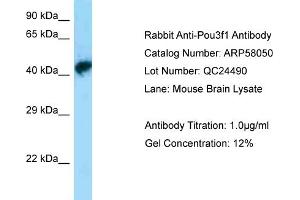 Western Blotting (WB) image for anti-POU Class 3 Homeobox 1 (POU3F1) (N-Term) antibody (ABIN2787528) (POU3F1 Antikörper  (N-Term))