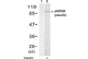 Image no. 1 for anti-Ribosomal Protein S6 Kinase, 90kDa, Polypeptide 1 (RPS6KA1) (pSer352) antibody (ABIN319221) (RPS6KA1 Antikörper  (pSer352))