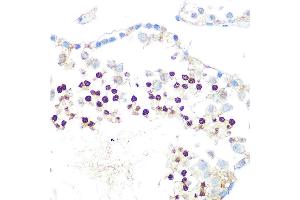 Immunohistochemistry of paraffin-embedded rat testis using HP1 alpha/CBX5Rabbit mAb (ABIN1678748, ABIN3018030, ABIN3018031 and ABIN7101571) at dilution of 1:100 (40x lens).