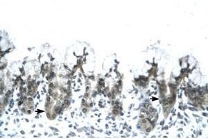 Image no. 1 for anti-Adiponectin (ADIPOQ) (AA 77-126) antibody (ABIN202115) (ADIPOQ Antikörper  (AA 77-126))