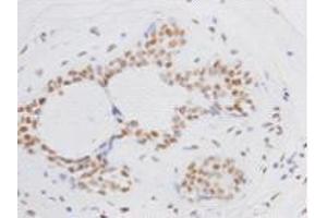 Immunohistochemistry (Paraffin-embedded Sections) (IHC (p)) image for anti-BMI1 Polycomb Ring Finger Oncogene (BMI1) antibody (ABIN1112825) (BMI1 Antikörper)
