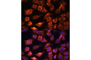 Immunofluorescence analysis of C6 cells using PTCD1 antibody (ABIN7269203) at dilution of 1:100. (PTCD1 Antikörper  (AA 435-537))