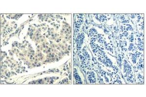 Immunohistochemistry (IHC) image for anti-Abelson Murine Leukemia Viral Oncogene Homolog 1/2 (ABL1/ABL2) (pTyr393), (pTyr439) antibody (ABIN7138994)