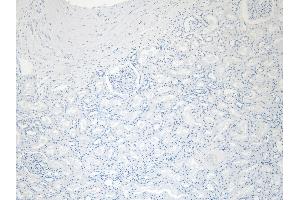 (ABIN185594) Negative Control showing staining of paraffin embedded Human Kidney, with no primary antibody (PRODH Antikörper  (Internal Region))