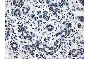 Immunohistochemical staining of paraffin-embedded breast tissue using anti-TTLL12 mouse monoclonal antibody. (TTLL12 Antikörper)