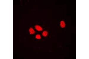Immunofluorescent analysis of EXO1 staining in A431 cells. (Exonuclease 1 Antikörper  (N-Term))