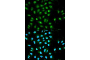 Immunofluorescence analysis of HeLa cells using PYCARD antibody (ABIN5970516).