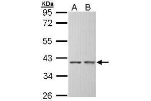 WB Image Sample (30 ug of whole cell lysate) A: Hep G2 , B: Molt-4 , 10% SDS PAGE antibody diluted at 1:5000