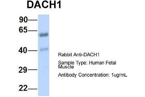 Host:  Rabbit  Target Name:  DACH1  Sample Type:  Human Fetal Muscle  Antibody Dilution:  1. (DACH1 Antikörper  (N-Term))