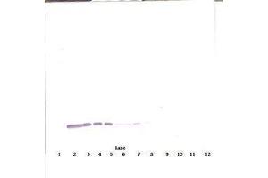 Image no. 2 for anti-Colony Stimulating Factor 2 (Granulocyte-Macrophage) (CSF2) antibody (ABIN465747) (GM-CSF Antikörper)