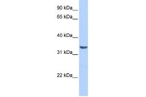 RAB40A antibody used at 1 ug/ml to detect target protein.