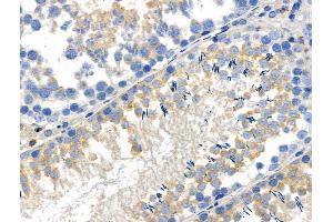 Phospho-WNK4 (Ser575) Antibody at 1/100 staining Rat testis tissue by IHC-P.