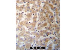 DHFRL1 Antibody (Center) (ABIN657287 and ABIN2846374) immunohistochemistry analysis in formalin fixed and paraffin embedded human liver tissue followed by peroxidase conjugation of the secondary antibody and DAB staining. (DHFRL1 Antikörper  (AA 45-74))