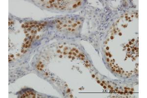 Immunoperoxidase of monoclonal antibody to NEK2 on formalin-fixed paraffin-embedded human testis. (NEK2 Antikörper  (AA 331-445))