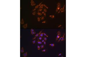 Immunofluorescence analysis of H9C2 cells using TRH Rabbit pAb (ABIN7270826) at dilution of 1:100. (TRH Antikörper  (AA 100-200))