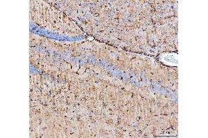 IHC analysis of Aquaporin 4 using anti-Aquaporin 4 antibody (ABIN3043789).