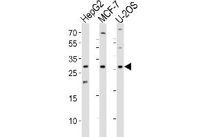 Western blot analysis of lysates from HepG2, MCF-7, U-2OS cell line (from left to right), using ID1 Antibody at 1:1000 at each lane.