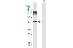 Western Blot analysis of DCT expression in transfected 293T cell line by DCT MaxPab polyclonal antibody. (DCT Antikörper  (AA 1-519))