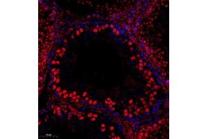 Immunofluorescent analysis of paraffin embedded mouse testis using RPL10L (ABIN7075429) at dilution of 1: 650 (RPL10L Antikörper)
