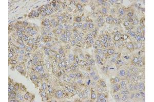 Immunohistochemistry (IHC) image for anti-Carnitine Palmitoyltransferase 1A (Liver) (CPT1A) antibody (ABIN1876495) (CPT1A Antikörper)