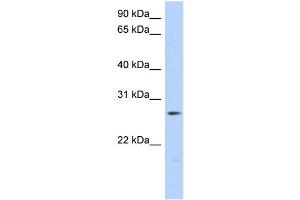 WB Suggested Anti-MTHFS Antibody Titration: 0. (MTHFS Antikörper  (Middle Region))