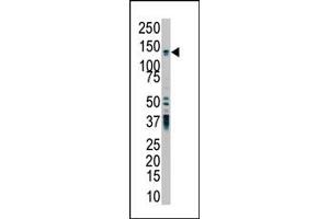 The anti-PKD2 Pab (ABIN392443 and ABIN2842041) is used in Western blot to detect PKD2 in HL-60 cell lysate. (PKD2 Antikörper  (C-Term))