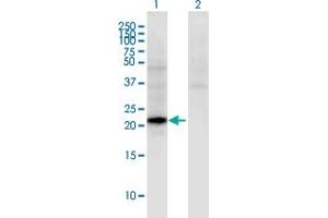 Western Blot analysis of CGB5 expression in transfected 293T cell line by CGB5 monoclonal antibody (M02), clone 2E7. (CGB5 Antikörper  (AA 1-165))