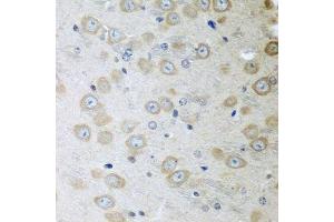 Immunohistochemistry of paraffin-embedded mouse brain using ATAD3A antibody. (ATAD3A Antikörper  (AA 1-240))