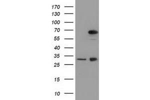 Western Blotting (WB) image for anti-Membrane Protein, Palmitoylated 3 (MAGUK P55 Subfamily Member 3) (MPP3) antibody (ABIN1499549) (MPP3 Antikörper)