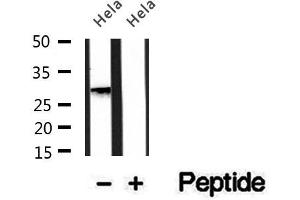 Western blot analysis of extracts of HepG2 cells, using PMM2 antibody. (PMM2 Antikörper  (C-Term))