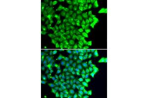 Immunofluorescence analysis of MCF-7 cells using TRIAP1 antibody (ABIN4905489). (TRIAP1 Antikörper)